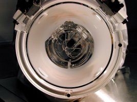 tscope10-topview2